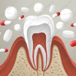 Лучшая имплантация зубов в СПб. 
 Как снять зубную боль