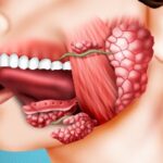 Лучшая имплантация зубов в СПб. 
 Сиалоаденит, диагностика и лечение воспаления