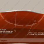 Лучшая имплантация зубов в СПб. 
 Белое пятно на десне болит