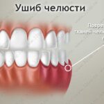 Лучшая имплантация зубов в СПб. 
 Лечение челюсти